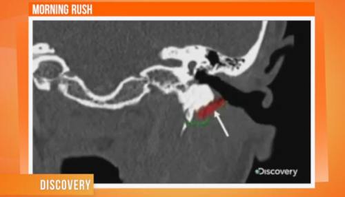 !!!FleshEatingWorms!