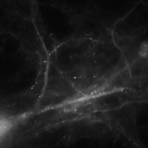 !!!!!livingBrainCells1