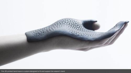 !!!!!3DPrintedHandBrace1