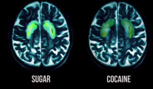 !!!!!whatHappensToYourBrainOnSugar1