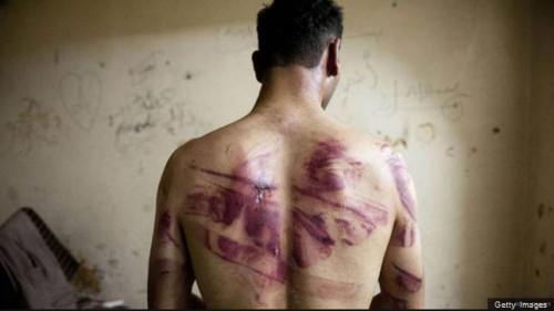 !!!!!SyrianTorture1
