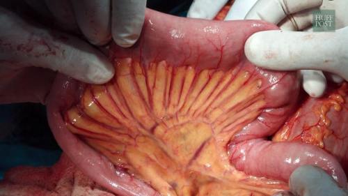 forjamesnewhumanorgan1