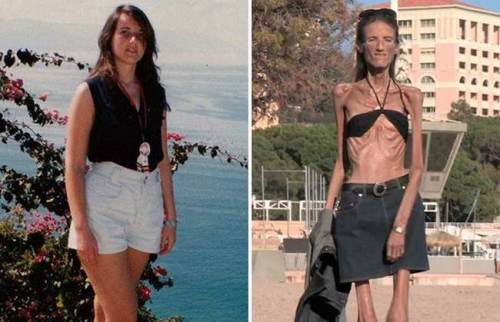 Life and death of the skinny woman on the planet